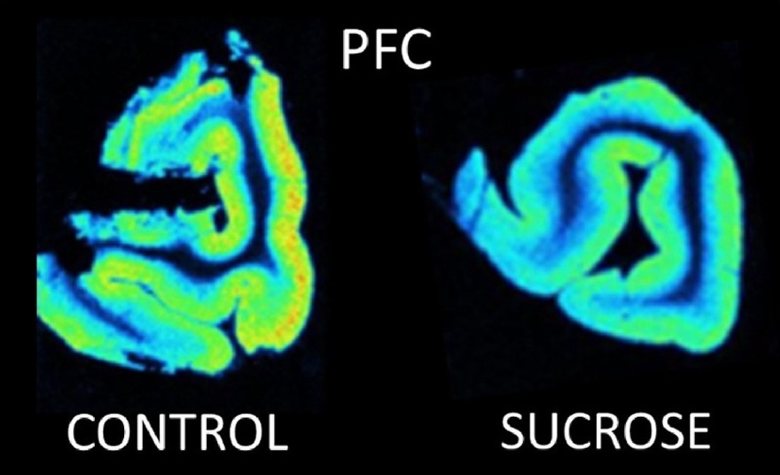 Two pseudo-colour autoradiograms of minipig prefrontal cortex, labelled control and sucrose; the folded cortical ribbon shows more green and yellow in the control section and more blue in the sucrose section.