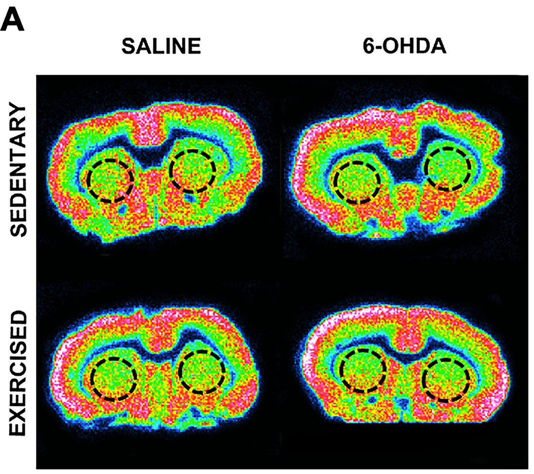Four coronal rat brain autoradiograms of [3H]UCB-J binding at striatal level, arranged saline versus 6-OHDA and sedentary versus exercised, with dashed circles over the left and right striatum.