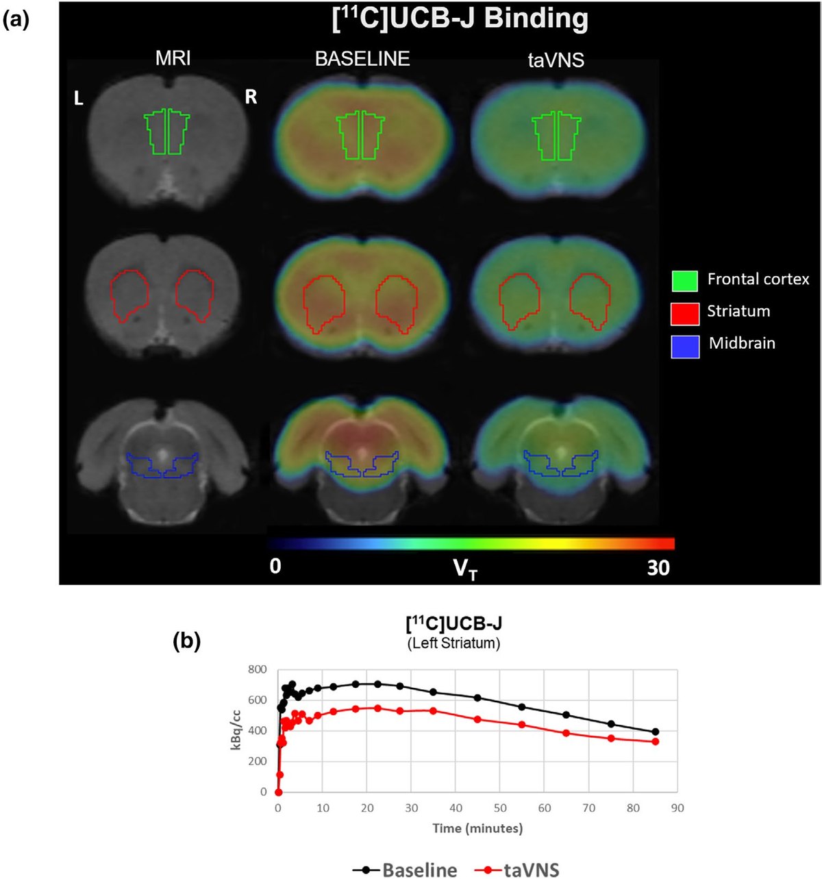 Figure from Binda et al. 2025. Panel a: coronal rat brain slices; columns show MRI, [11C]UCB-J V_T maps at baseline, and V_T maps after taVNS, with frontal cortex, striatum and midbrain outlined; colour scale V_T 0 to 30. Panel b: time–activity curves in the left striatum, radioactivity in kBq/cc over 90 minutes, baseline in black and after taVNS in red.