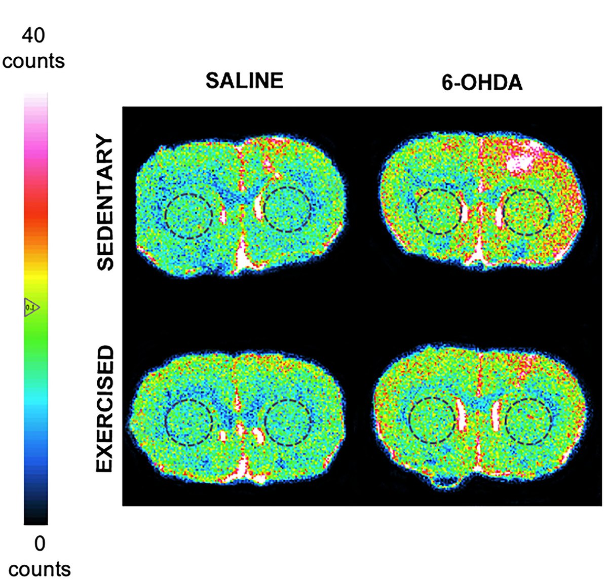 Four colour-coded autoradiograms of coronal rat brain sections through the striatum, arranged by injection (saline, 6-OHDA) and group (sedentary, exercised), beside a colour scale from 0 to 40 counts. The sedentary 6-OHDA section shows higher binding, in red, over one hemisphere.