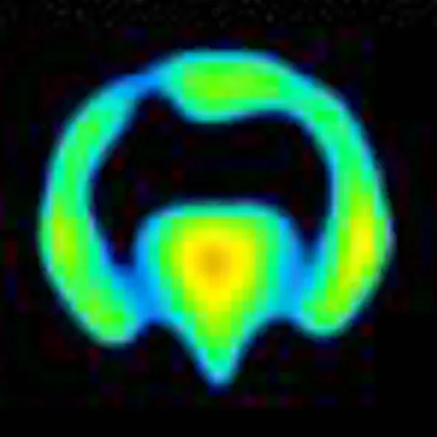 Coronal PET map 8 minutes after nisoxetine.