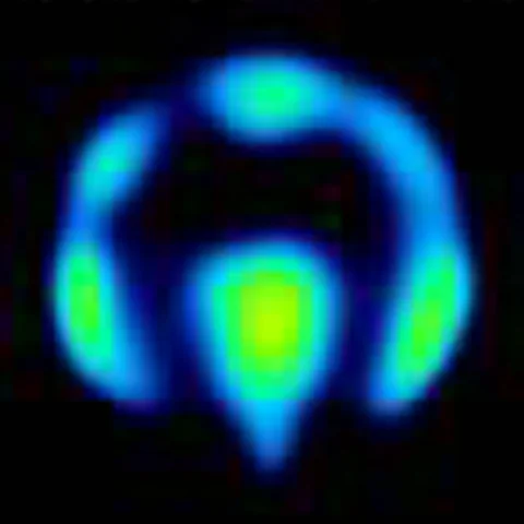 Coronal PET map 4 hours after nisoxetine.