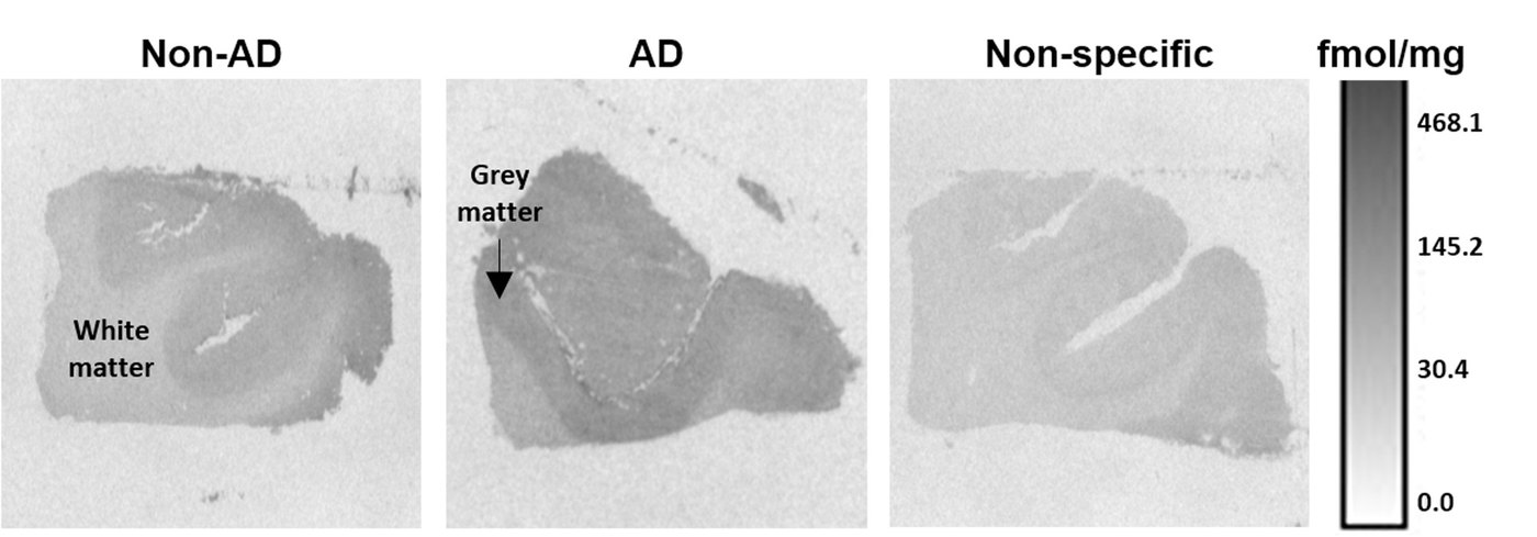 Three greyscale autoradiograms of human frontal cortex sections labelled Non-AD, AD and Non-specific, beside a binding scale from 0 to 468 fmol/mg.