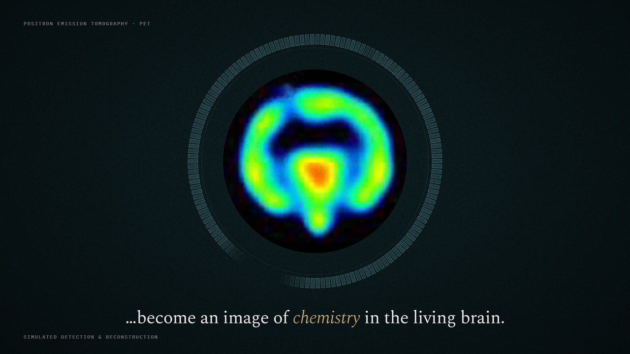 Detected PET events reconstructed into a brain image, from the lab's film