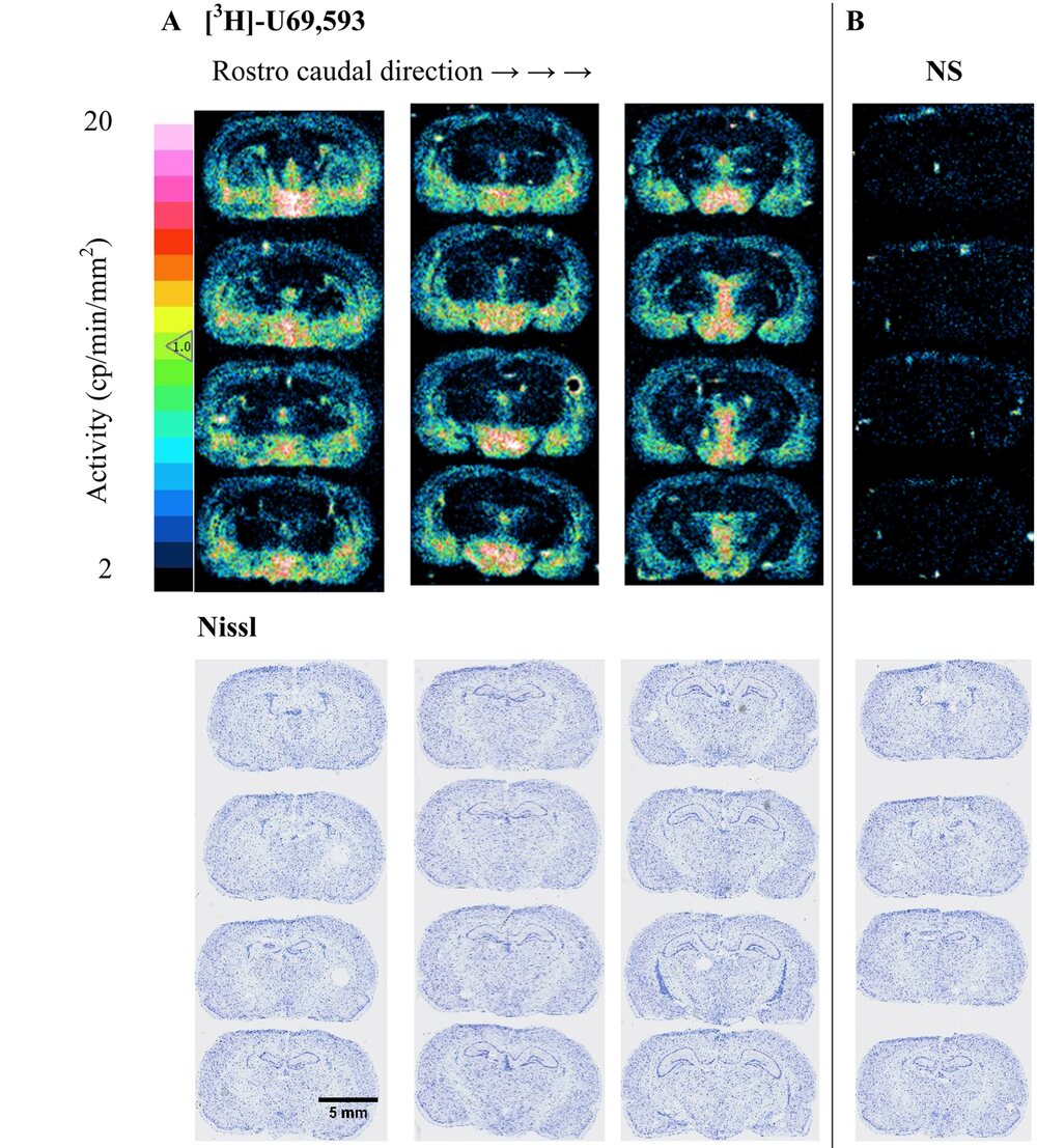Top: twelve rat brain autoradiograms of [3H]U69,593 binding with a colour bar from 2 to 20 counts per minute per square millimetre, beside four non-specific sections. Bottom: the same sections after Nissl staining, in pale blue, with a 5 millimetre scale bar.
